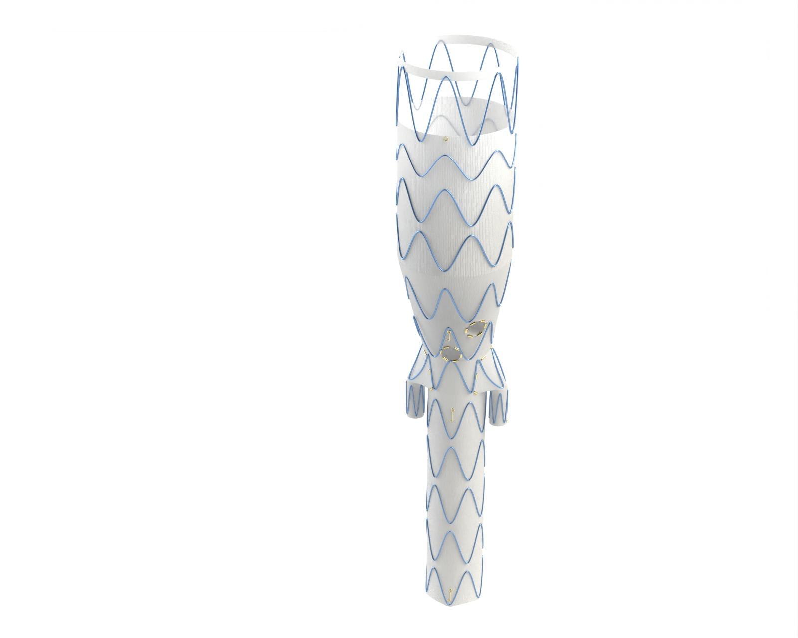 Comprehensive Thoraco-abdominal CMD stent graft for complex aortic pathologies